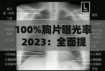 100%胸片曝光率 2023：全面提升医疗诊断准确性与质量的关键指标