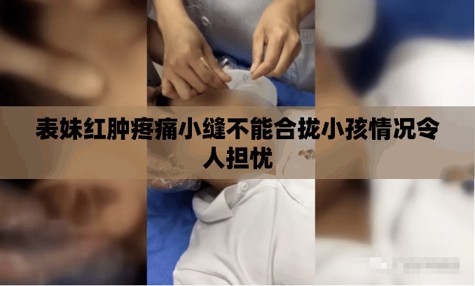 表妹红肿疼痛小缝不能合拢小孩情况令人担忧