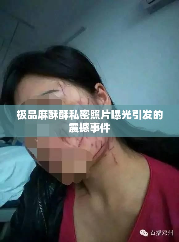 极品麻酥酥私密照片曝光引发的震撼事件