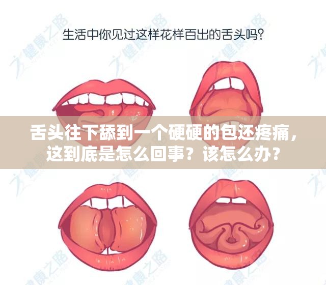 舌头往下舔到一个硬硬的包还疼痛，这到底是怎么回事？该怎么办？